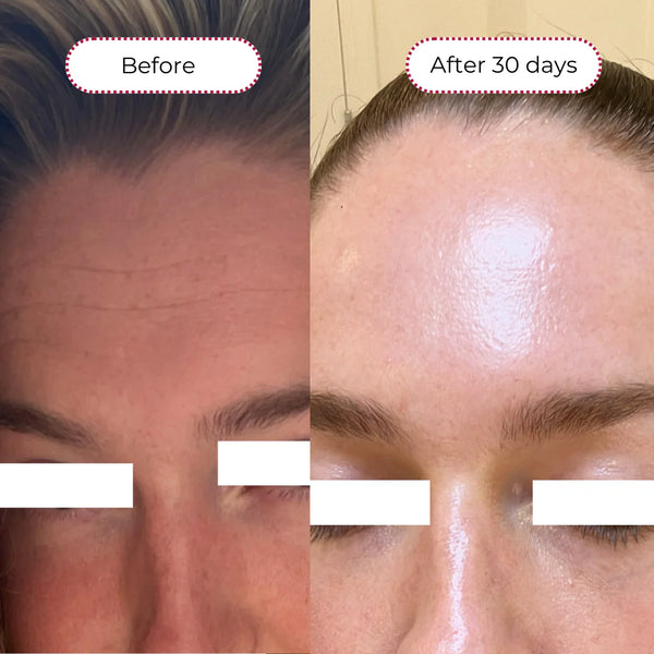 THE AHA PEEL